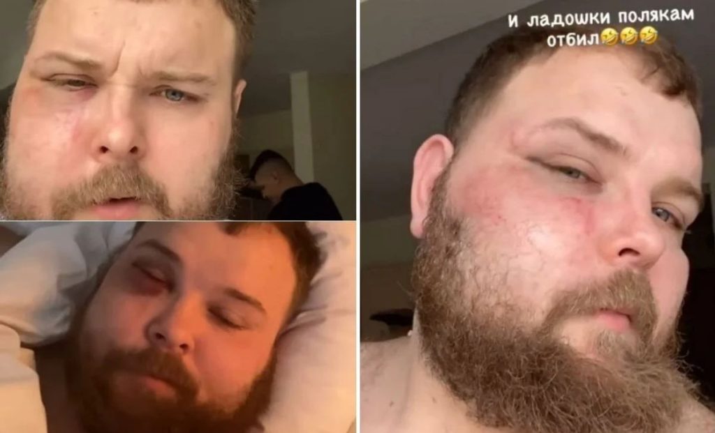 Ruski kralj šamaranja dobio neviđene batine!