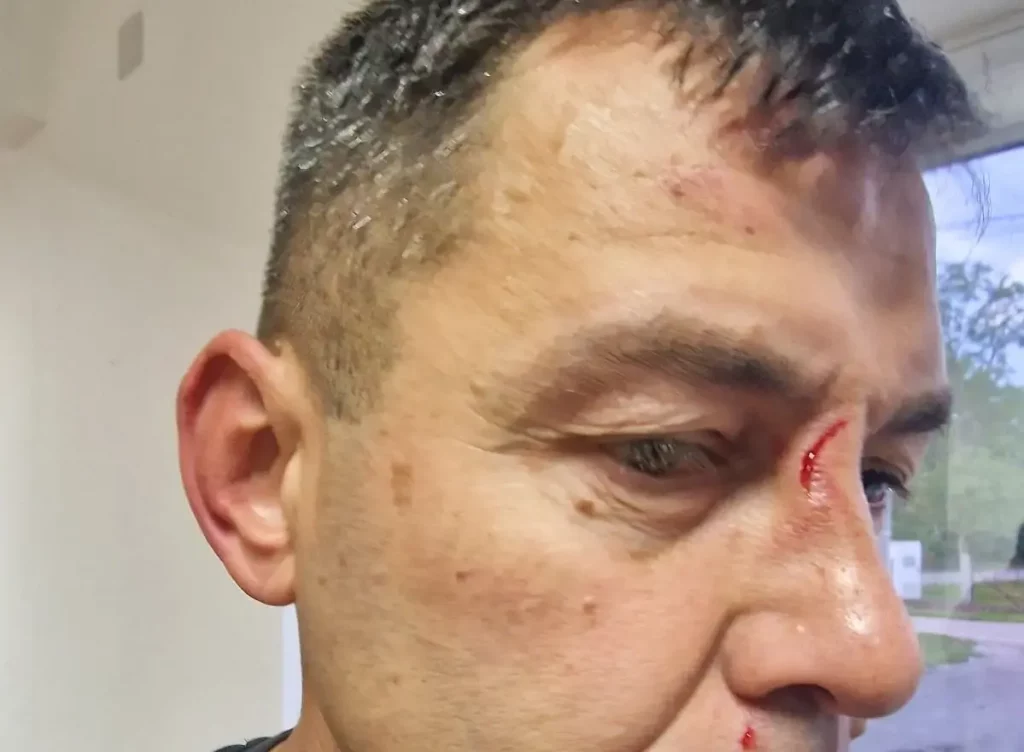 Strašne scene u Područnoj ligi: Otac i sin brutalno pretukli sudiju