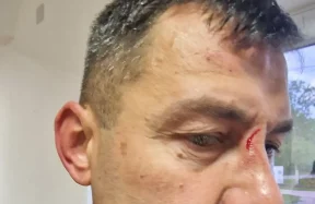 Strašne scene u Područnoj ligi: Otac i sin brutalno pretukli sudiju