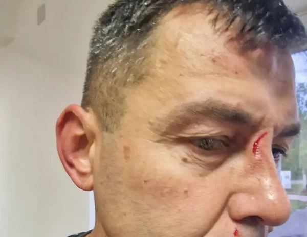 Strašne scene u Područnoj ligi: Otac i sin brutalno pretukli sudiju</a>