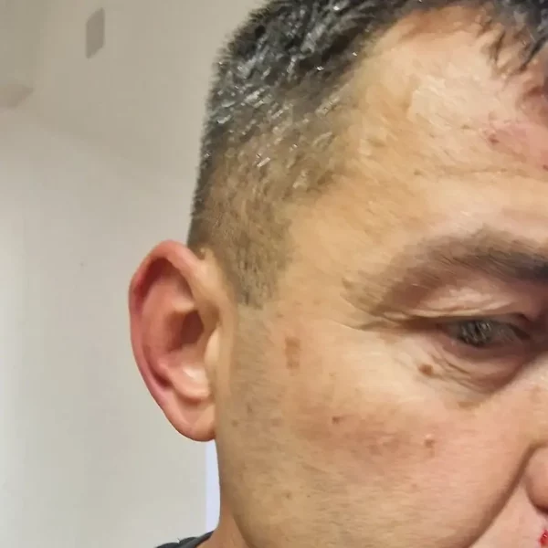 Strašne scene u Područnoj ligi: Otac i sin brutalno pretukli sudiju