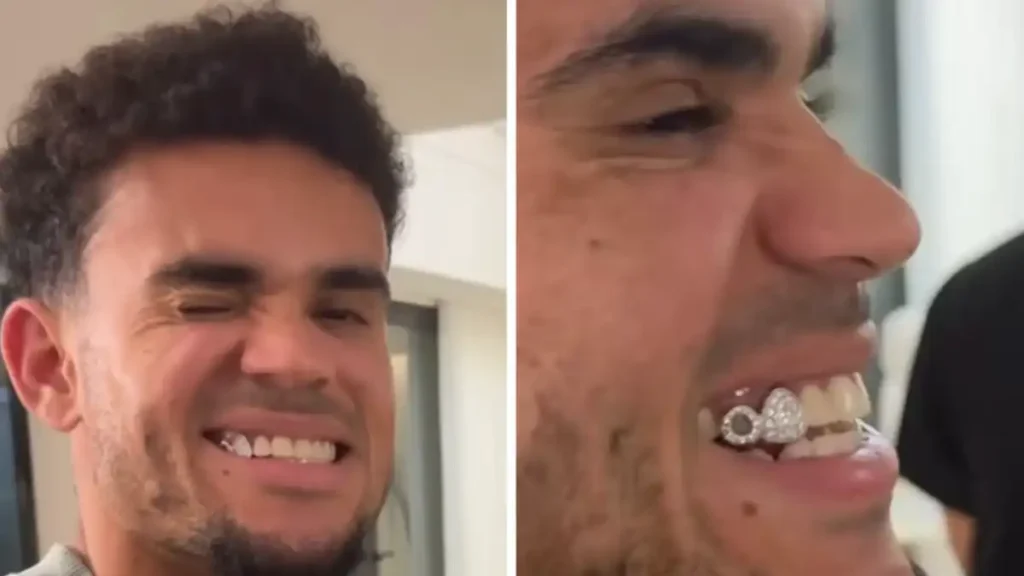 “Grillz”: Zvijezda Bayerna na SP putuje s dijamantima na zubima luis diaz navlake